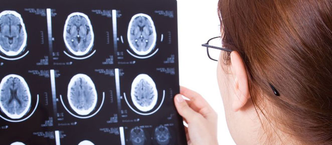 Brain Imaging Brain Imaging